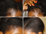 How to Prevent and Treat Hair Loss & Damage